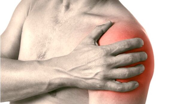 Swollen, red and enlarged shoulder - symptoms of arthrosis of the shoulder joint 2-3 degrees