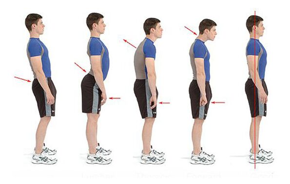 Preventing osteochondrosis