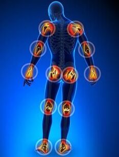 Localization of joint joints in the arthritis