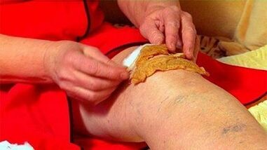 The joints of the knee joint joint joints