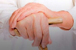 pain in the joints of the fingers in rheumatoid arthritis