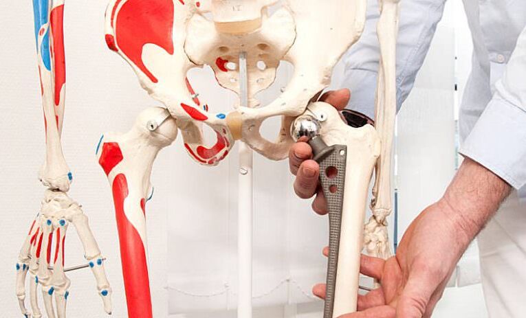 hip surgery in case of pain